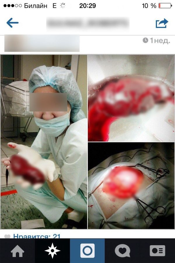 Шокирующие селфи с пациентом на операционном столе