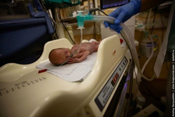 Репортаж из отделения реанимации новорожденных