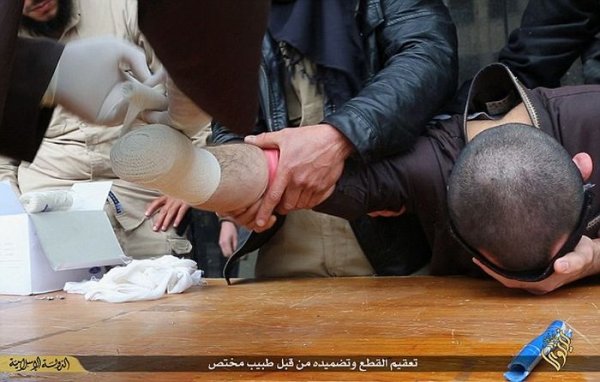 Боевики ИГИЛа вновь отрубили руку вору