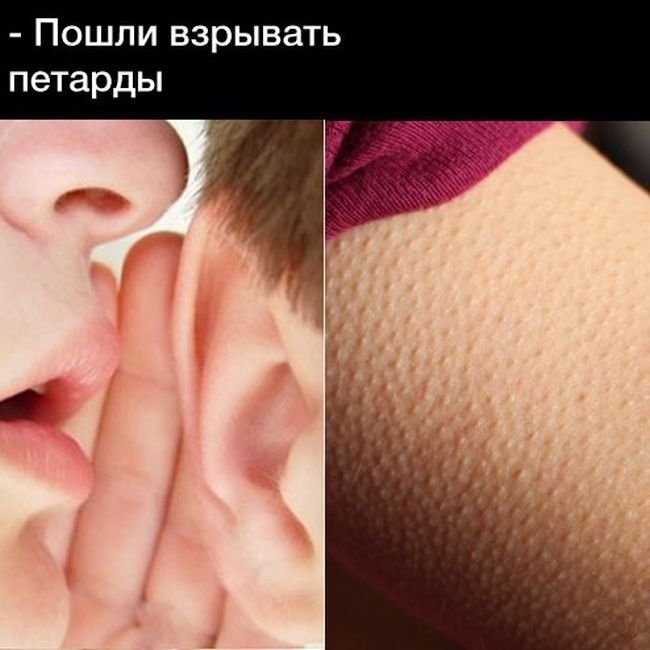    (131 )