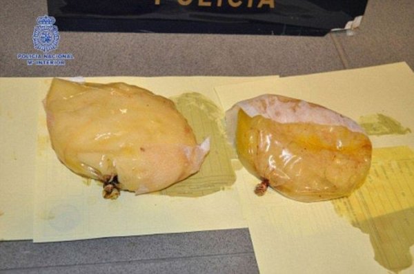 Кокаиновые импланты для транспортировки наркотиков через границу