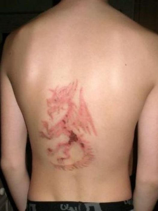 Временные тату могут стать шрамированием на всю жизнь