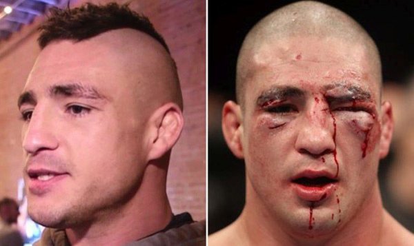 Лица бойцов UFC до и после боя