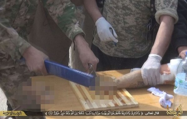 Боевики ИГИЛа вновь отрубили руку вору