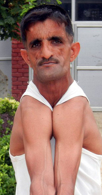 Раммехар Пуня, «резиновый человек» из Индии, побил собственный рекорд