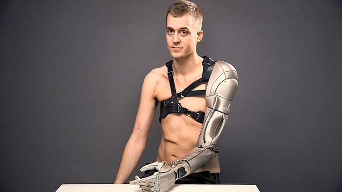  Британец получил бионическую руку, которую для него изготовили разработчики игр и спецэффектов в кино
