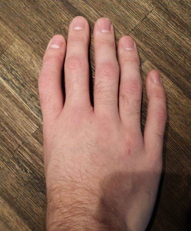  (50 )