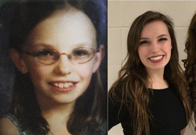 До и после: в подростковом возрасте и спустя несколько лет (17 фото)
