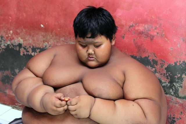12-летний индонезийский подросток Арья Пермана похудел на 95 килограмм (9 фото)