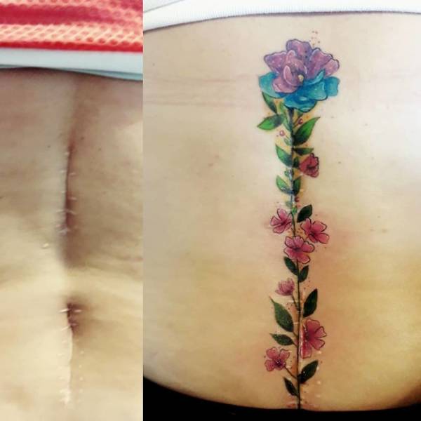 Татуировки, скрывающие изъяны на теле (41 фото)