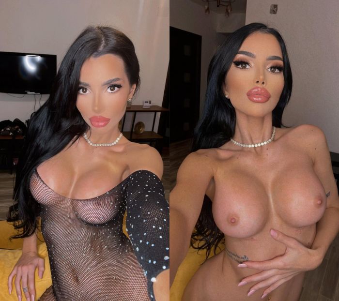     - 